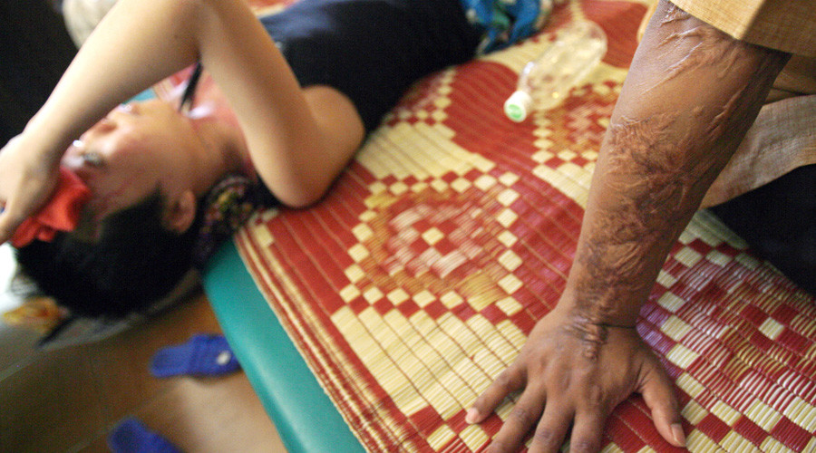 Indian authorities doubt story of woman who ‘suffered 5th acid attack’ despite police protection
