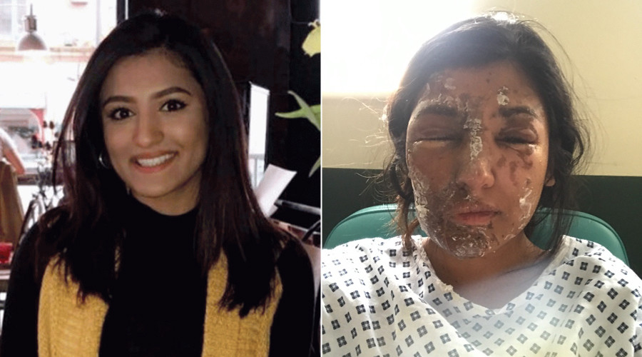 3 acid attacks reported every week in London, LBC finds
