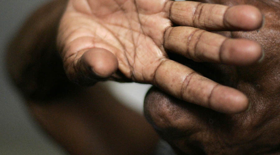 Poverty & stress put people at greater risk of dementia – Alzheimer’s experts