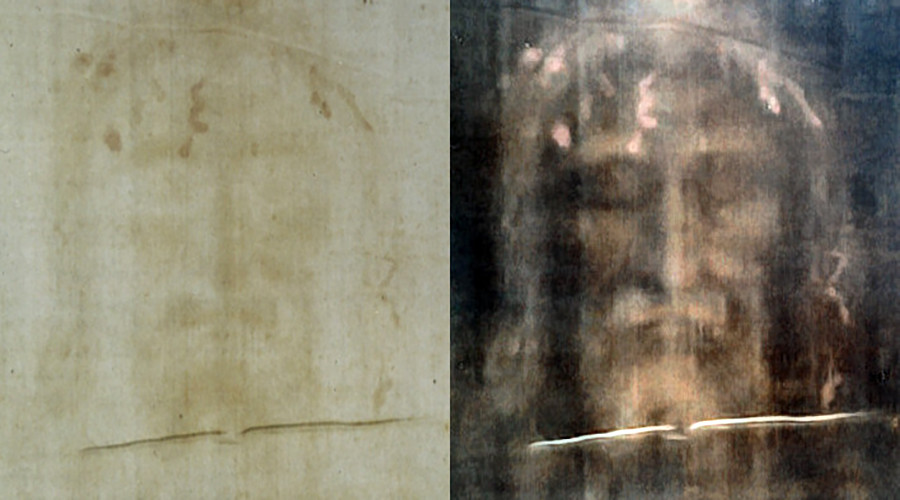 Turin Shroud is stained with the blood of a torture victim, new research reveals