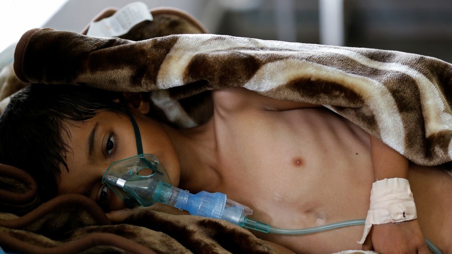 Starving children face ‘imminent risk of death’ due to Saudi assault on Yemeni city, UNICEF warns
