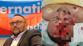 German AfD MP brutally beaten in âpolitically-motivated attempted assassinationâ (GRAPHIC)