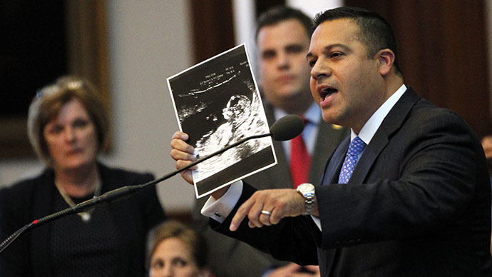 Texas State Representative Jason Villalba holds a sonogram of his thirteen-week-old son taken last week as he offers closing remarks during a meeting of the state legislature to consider legislation restricting abortion rights in Austin, Texas July 9, 2013. (Reuters / Mike Stone)