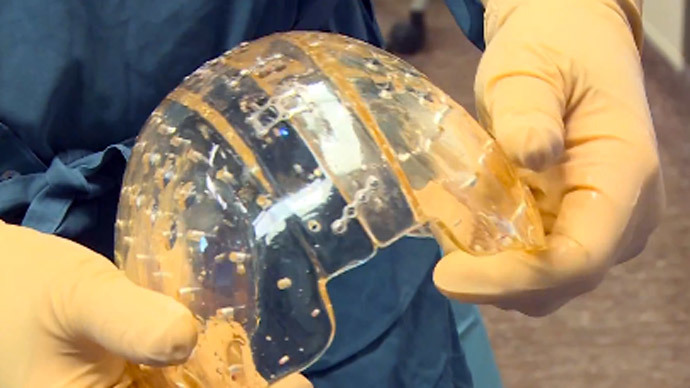 Surgeons perform 'world’s first' implant of entire 3D-printed plastic skull dome (VIDEO)