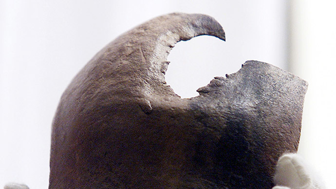 2,000yo Siberian brain surgery techniques recreated by Russian scientists