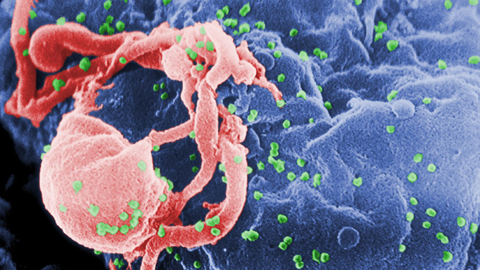 Aggressive HIV strain leading to AIDS in 3 years discovered in Cuba