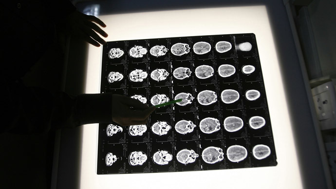 First head transplant possible within two years, says Italian ‘Frankensurgeon’