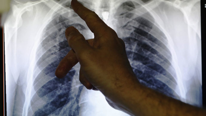 Kansas tuberculosis outbreak infects 28 high school students — RT America