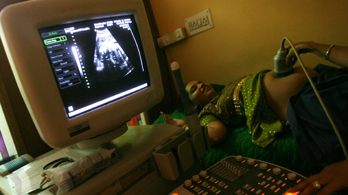 Males, females conceived evenly, but females have higher mortality rate during pregnancy