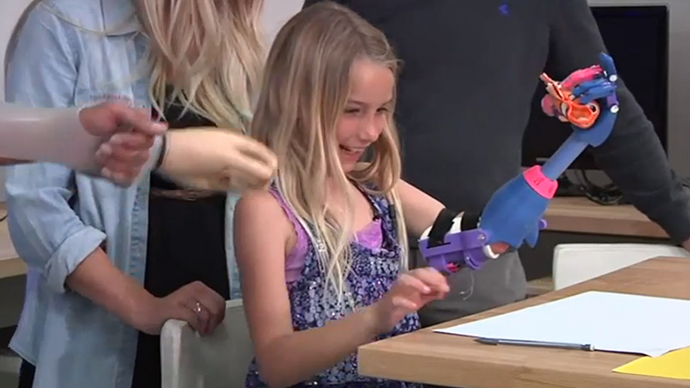 ‘Robohand’: 7yo girl gets 3D-printed prosthesis