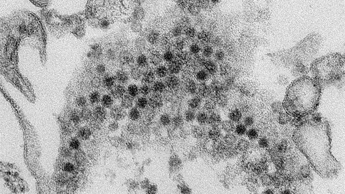 ‘Polio-like’ enterovirus could be behind paralysis of over 100 children – study