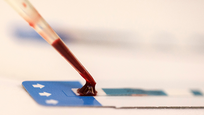 Cloned antibody shows promise for HIV patients