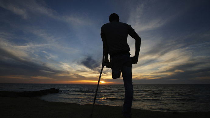 Florida man sues hospital after it threw away his leg in trash