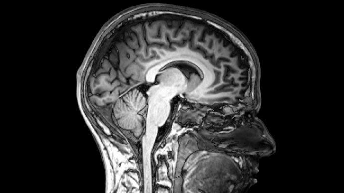 Scientists get first-ever visual glimpse into how new concepts form inside brain