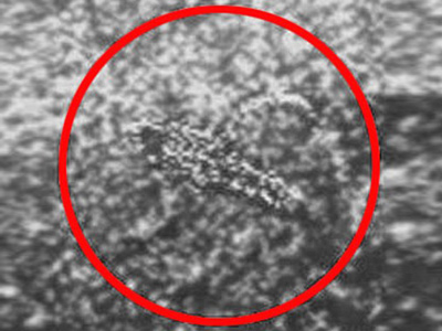 Signs of life: Alien ‘scorpions’ found on Venus? (PHOTOS)
