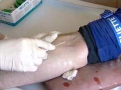Allegedly intentional AIDS infection investigated in Far East