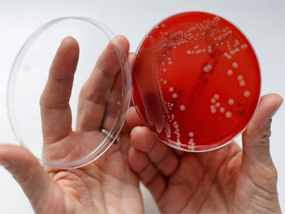 Antibiotic Armageddon: Drug resistant diseases could trigger UK apocalypse