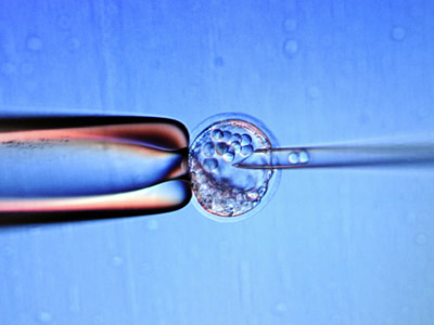 Gene monopoly: Australian court rules in favor of genetic patenting