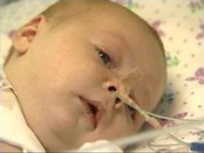 Baby girl's arm amputation under investigation in Krasnodar