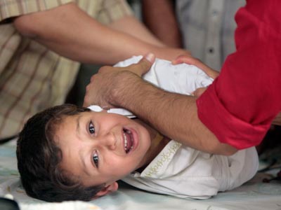 Circumcision in Berlin: Not outlawed, but restrictive