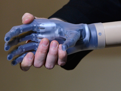 Touching breakthrough: Bionic hand to return sense of feeling