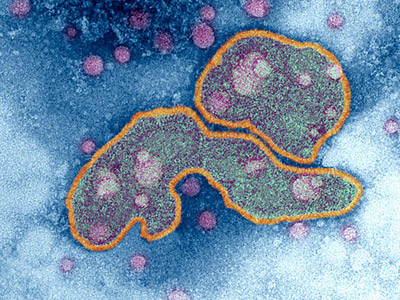 Man-made super-flu could kill half humanity