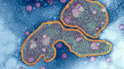 Avian influenza virus, TEM (NIBSC/Science Photo Library)