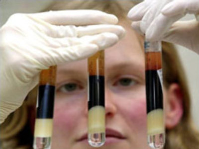 BLOODchip makes blood transfusions safer