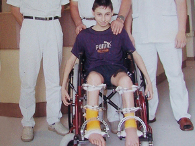 Boy with reattached legs joins Russian army