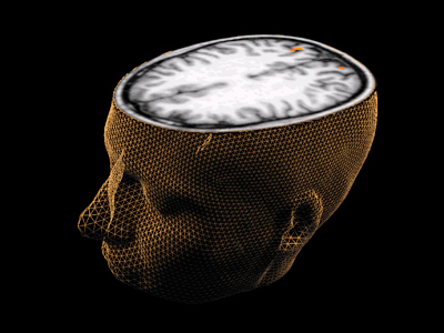 Can a brain scan reveal how smart you are?