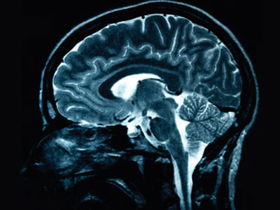 PC vs. Mac: Brain scans don’t look the same on different computers