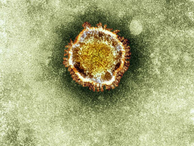 First patient dies in UK from SARS-like novel coronavirus