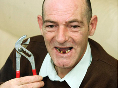 Couldn’t afford dentist, used pliers