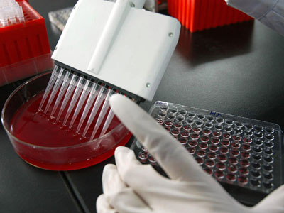 New deadly SARS-like virus has potential to transfer from human to human