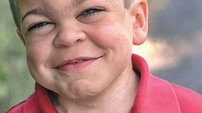 Rare disease and lack of money – death sentence for kids (Image from shire.com)