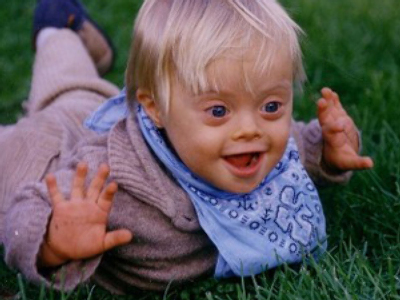 Facebook page unites anti-Down Syndrome activists, sparks controversy