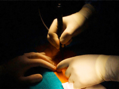 Drape kills patient after 14 years