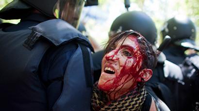 Blood flows down the face of an injured protester who was injured during clashes between supporters of Spanish coal miners and riot police as they ended a "Marcha Negra" (Black March) near the Industry Ministry in Madrid July 11, 2012 (Reuters/Paul Hanna)