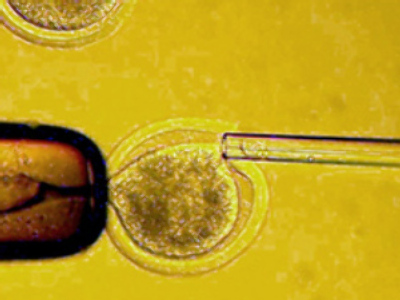 First GM human embryo raises fears of designer babies