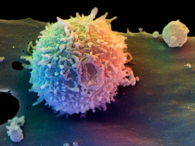Immune system's door unlocked: Science finds out why specific cells let HIV in