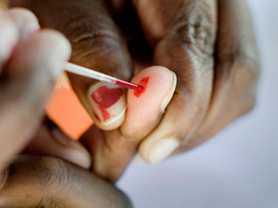 On-the-spot AIDS test: S. Africans to get revolutionary smartphone gadget