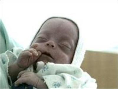 Three months premature baby will live to tell the tale