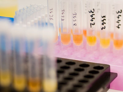 WADA poured dope into athlete probe