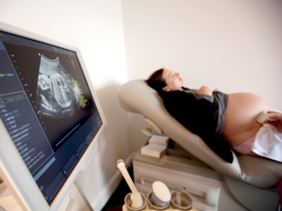 Life before conception: Arizona anti-abortion law defies science