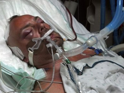 Cop keeps job after brutal restaurant attack leaves victim in critical condition