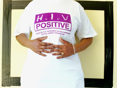 HIV now an epidemic among blacks in the US