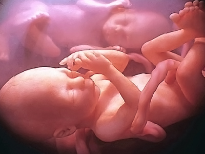 Texas law forces abortion seekers to get a sonogram