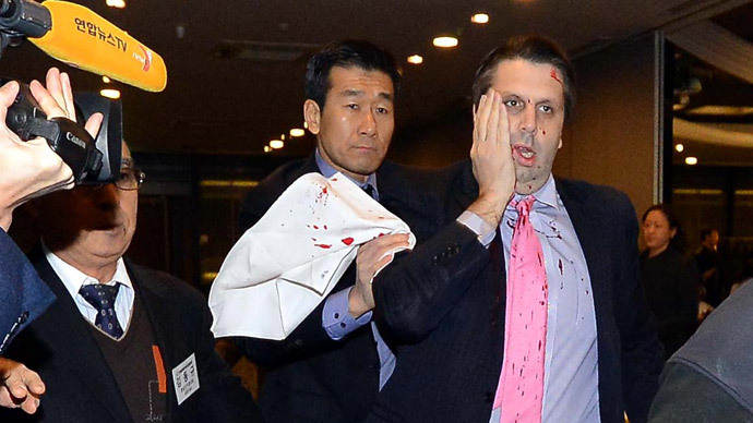 ‘US needs to end the Korean War’