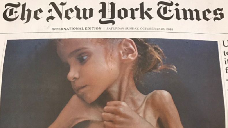 Fillette morte de la famine au Yémen : comment Facebook a censuré une photo du New York Times